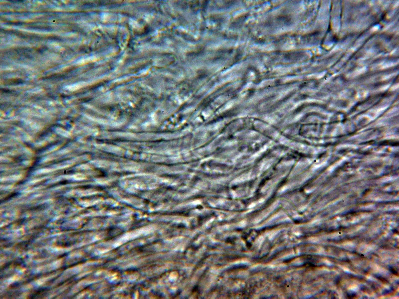 10 - Subpellis agua 1